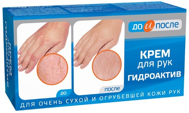 До и после крем д/рук гидроактивный 100мл